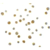 Immunocytochemistry - Anti-DYRK1A antibody - C-terminal (AB180910)