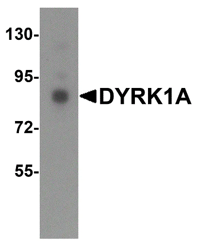 Western blot - Anti-DYRK1A antibody - C-terminal (AB180910)