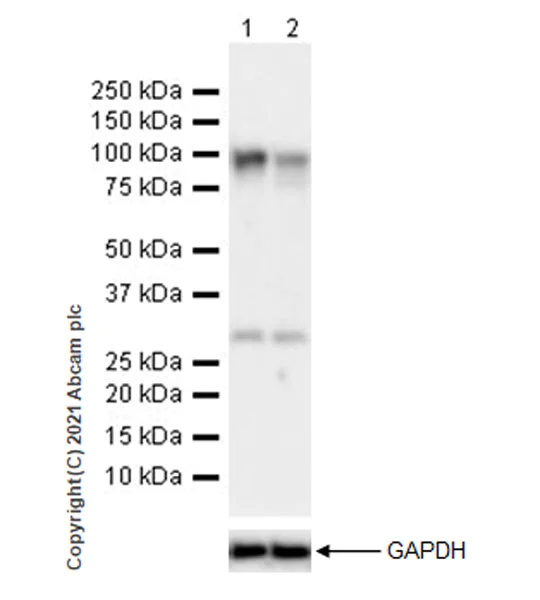 Western blot - Anti-DYRK1A antibody [EPR24132-61] (AB259869)