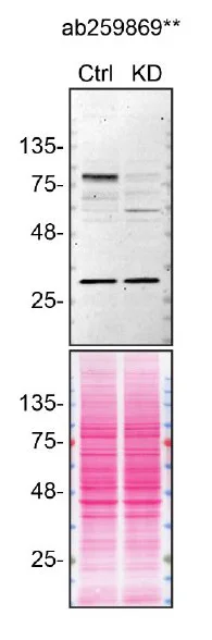 Western blot - Anti-DYRK1A + DYRK1B antibody [EPR24132-61] - BSA and Azide free (AB280359)