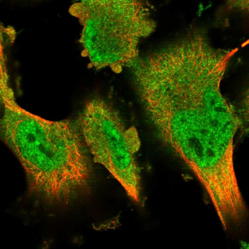 Immunocytochemistry/ Immunofluorescence - Anti-DYRK2 antibody (AB246959), expandable thumbnail