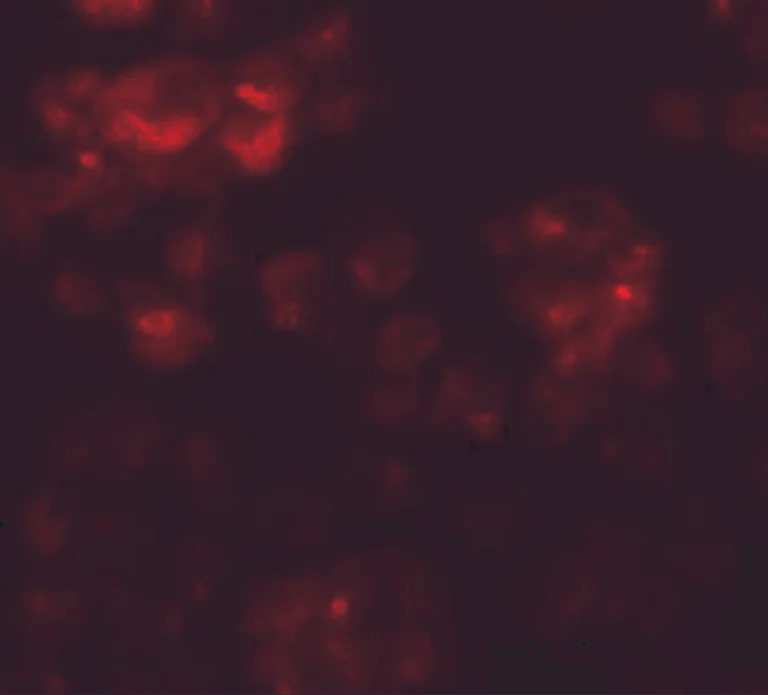 Immunocytochemistry - Anti-DYRK2 antibody (AB254567)