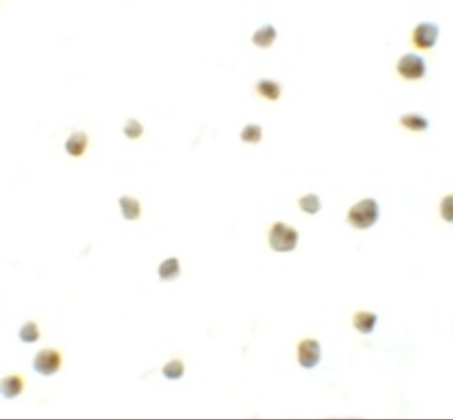 Immunocytochemistry - Anti-DYRK2 antibody (AB254567)