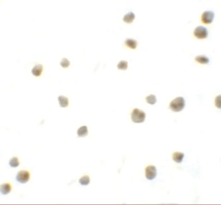 Immunocytochemistry - Anti-DYRK2 antibody (AB254567)