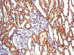 Immunohistochemistry (Formalin/PFA-fixed paraffin-embedded sections) - Anti-Dysbindin antibody [EPR7041] (AB133652)