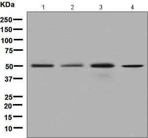 Western blot - Anti-Dysbindin antibody [EPR7041] (AB133652)