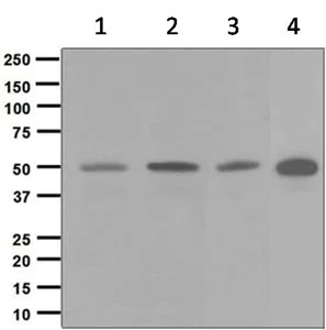 Western blot - Anti-Dysbindin antibody [EPR7042(B)] (AB124967)