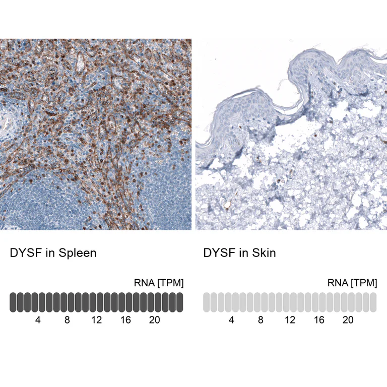 Immunohistochemistry (Formalin/PFA-fixed paraffin-embedded sections) - Anti-DYSF Antibody [CL10888] (AB327131)