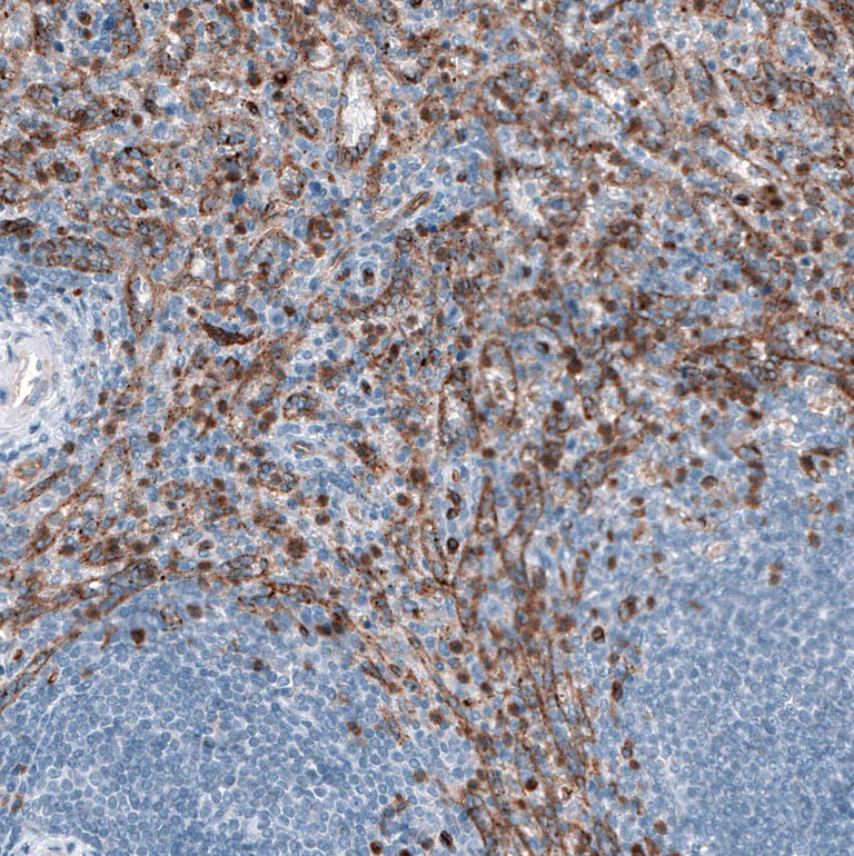 Immunohistochemistry (Formalin/PFA-fixed paraffin-embedded sections) - Anti-DYSF Antibody [CL10888] (AB327131)