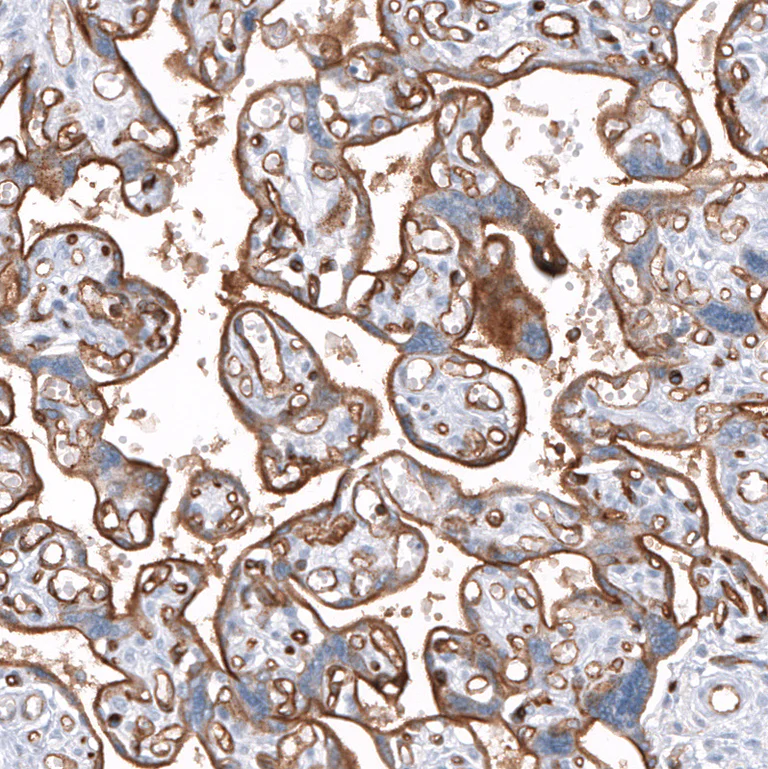 Immunohistochemistry (Formalin/PFA-fixed paraffin-embedded sections) - Anti-DYSF Antibody [CL10888] (AB327131)