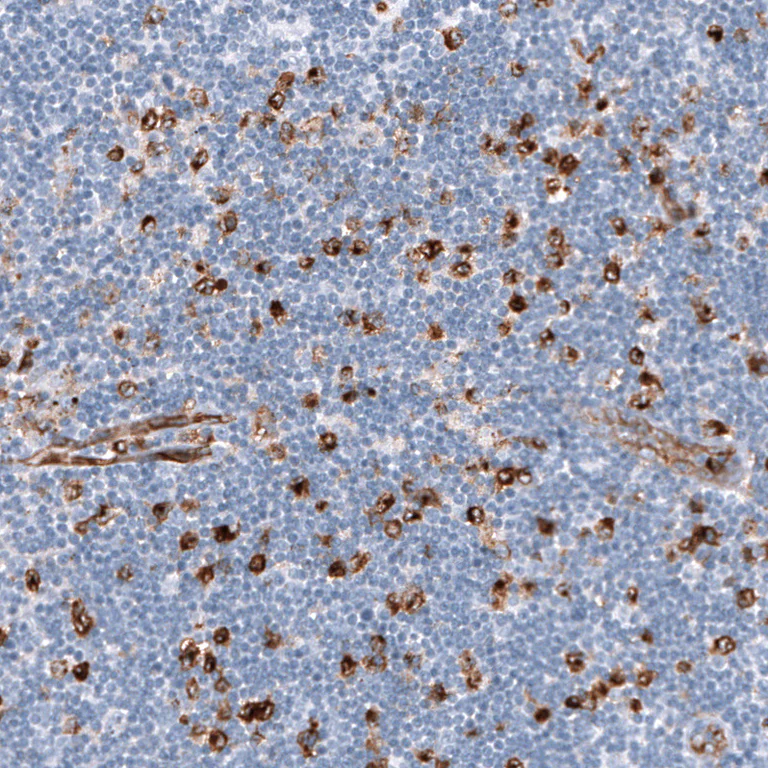 Immunohistochemistry (Formalin/PFA-fixed paraffin-embedded sections) - Anti-DYSF Antibody [CL10888] (AB327131)