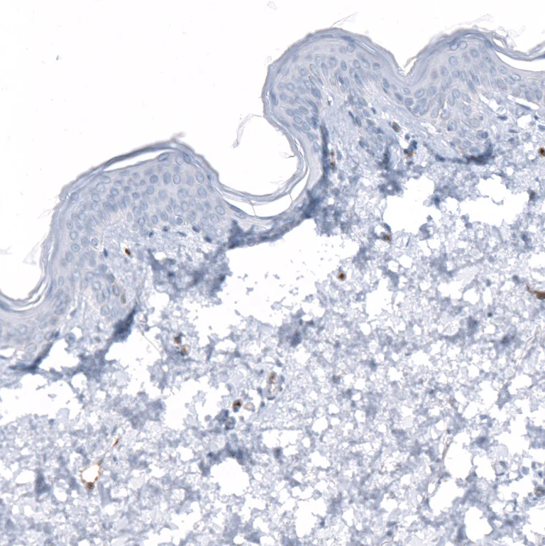 Immunohistochemistry (Formalin/PFA-fixed paraffin-embedded sections) - Anti-DYSF Antibody [CL10888] (AB327131)