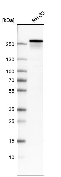 Western blot - Anti-DYSF Antibody [CL10888] (AB327131)