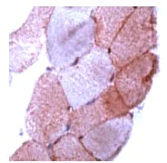 Immunohistochemistry (Formalin/PFA-fixed paraffin-embedded sections) - Anti-Dysferlin antibody (AB15108)