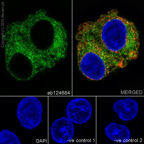Immunocytochemistry/ Immunofluorescence - Anti-Dysferlin antibody [JAI-1-49-3] (AB124684), expandable thumbnail