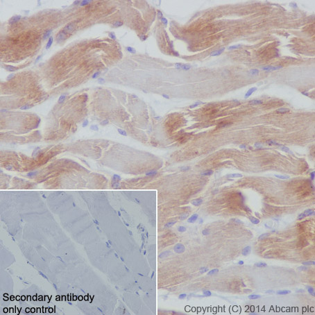 Immunohistochemistry (Formalin/PFA-fixed paraffin-embedded sections) - Anti-Dysferlin antibody [JAI-1-49-3] (AB124684), expandable thumbnail