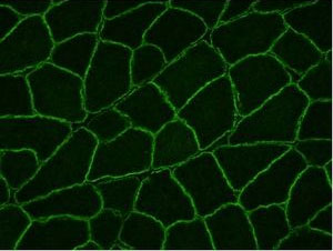 Immunohistochemistry (Frozen sections) - Anti-Dysferlin antibody [JAI-1-49-3] (ab124684), expandable thumbnail