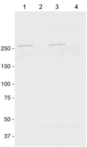 Western blot - Anti-Dysferlin antibody [JAI-1-49-3] (ab124684), expandable thumbnail