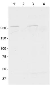 Western blot - Anti-Dysferlin antibody [JAI-1-49-3] (AB124684)
