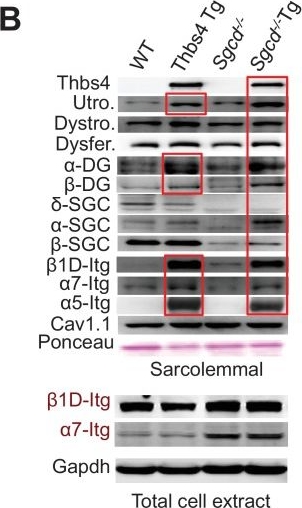 Western blot - Anti-Dysferlin antibody [JAI-1-49-3] (ab124684), expandable thumbnail