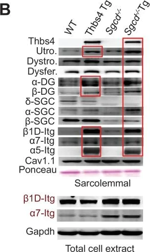 Western blot - Anti-Dysferlin antibody [JAI-1-49-3] (AB124684)