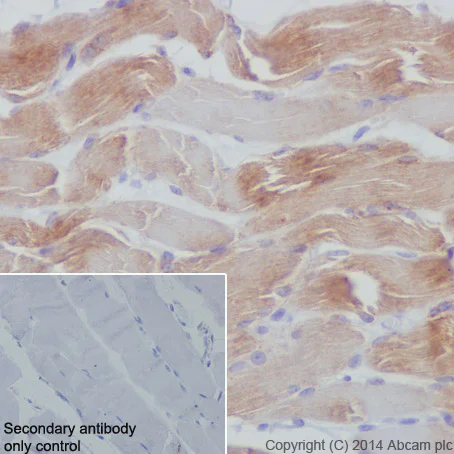 Immunohistochemistry (Formalin/PFA-fixed paraffin-embedded sections) - Anti-Dysferlin antibody [JAI-1-49-3] - BSA and Azide free (AB209877)