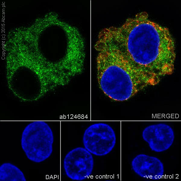 Immunocytochemistry/ Immunofluorescence - Anti-Dysferlin antibody [JAI-1-49-3] - Low endotoxin, Azide free (AB215376)