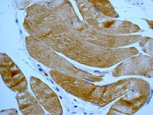 Immunohistochemistry (Formalin/PFA-fixed paraffin-embedded sections) - Anti-Dysferlin antibody [JAI-1-49-3] - Low endotoxin, Azide free (AB215376)