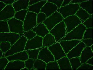 Immunohistochemistry (Frozen sections) - Anti-Dysferlin antibody [JAI-1-49-3] - Low endotoxin, Azide free (AB215376)
