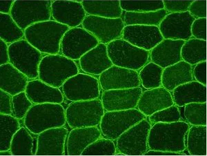 Immunohistochemistry (Frozen sections) - Anti-Dysferlin antibody [JAI-1-49-3] - Low endotoxin, Azide free (AB215376)