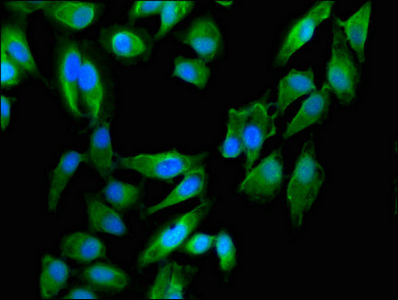 Immunocytochemistry/ Immunofluorescence - Anti-Dystonin/BPA antibody (AB234644)