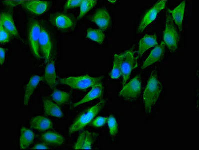 Immunocytochemistry/ Immunofluorescence - Anti-Dystonin/BPA antibody (AB234644)