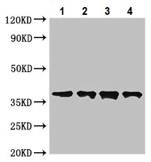 Western blot - Anti-Dystonin/BPA antibody (AB234644)