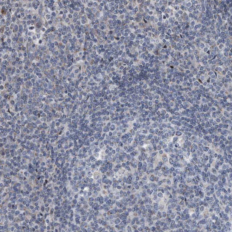 Immunohistochemistry (Formalin/PFA-fixed paraffin-embedded sections) - Anti-Dystonin/BPA antibody (AB244440)