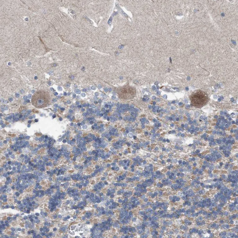 Immunohistochemistry (Formalin/PFA-fixed paraffin-embedded sections) - Anti-Dystonin/BPA antibody (AB244440)