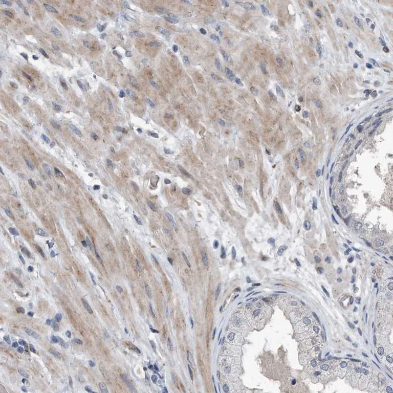 Immunohistochemistry (Formalin/PFA-fixed paraffin-embedded sections) - Anti-Dystonin/BPA antibody (AB244440)