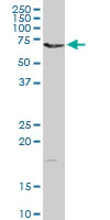 Western blot - Anti-Dystrophia myotonica protein kinase / DMPK antibody (AB102804)