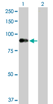 Western blot - Anti-Dystrophia myotonica protein kinase / DMPK antibody (AB102804)
