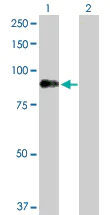 Western blot - Anti-Dystrophia myotonica protein kinase / DMPK antibody (AB102804)