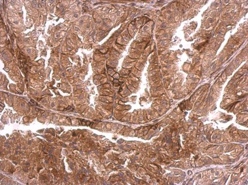 Immunohistochemistry (Formalin/PFA-fixed paraffin-embedded sections) - Anti-Dystrophia myotonica protein kinase / DMPK antibody (AB183860), expandable thumbnail