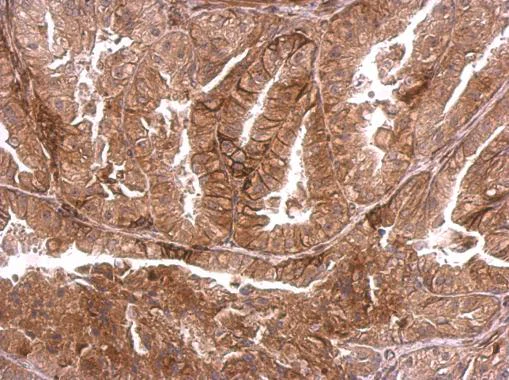 Immunohistochemistry (Formalin/PFA-fixed paraffin-embedded sections) - Anti-Dystrophia myotonica protein kinase / DMPK antibody (AB183860)