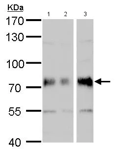 Western blot - Anti-Dystrophia myotonica protein kinase / DMPK antibody (AB183860)