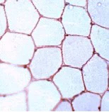 Immunohistochemistry (Formalin/PFA-fixed paraffin-embedded sections) - Anti-Dystrophin antibody (AB15277)