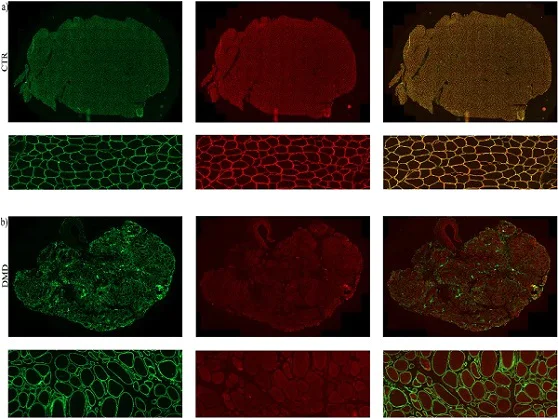 Immunohistochemistry (Formalin/PFA-fixed paraffin-embedded sections) - Anti-Dystrophin antibody (AB15277)