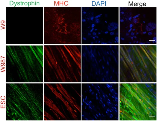 Immunohistochemistry (Frozen sections) - Anti-Dystrophin antibody (AB15277)