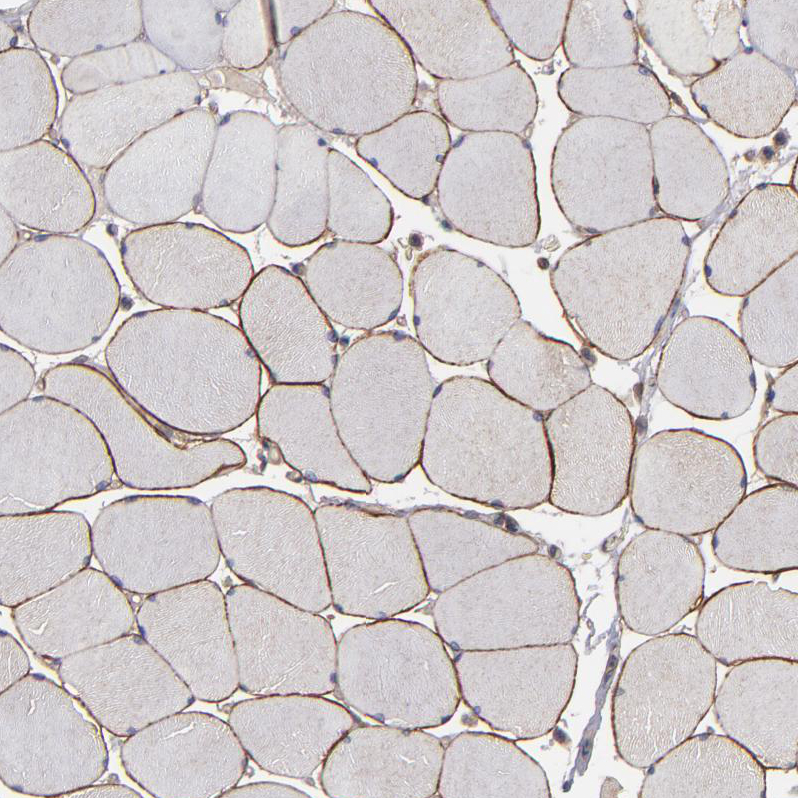 Immunohistochemistry (Formalin/PFA-fixed paraffin-embedded sections) - Anti-Dystrophin antibody (AB251665), expandable thumbnail