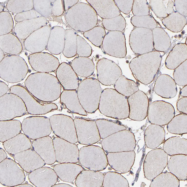 Immunohistochemistry (Formalin/PFA-fixed paraffin-embedded sections) - Anti-Dystrophin antibody (AB251665)