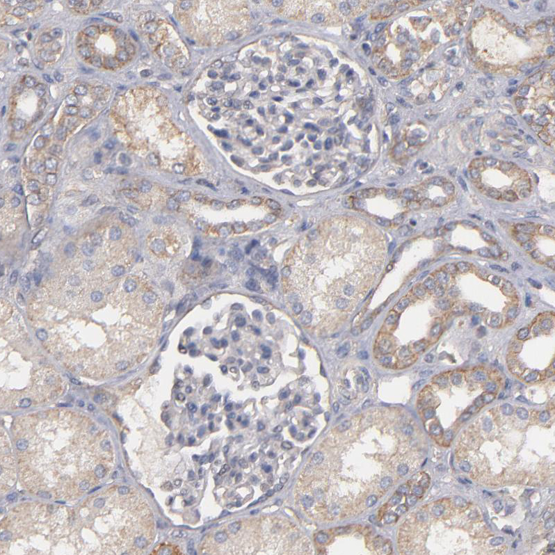 Immunohistochemistry (Formalin/PFA-fixed paraffin-embedded sections) - Anti-Dystrophin antibody (AB251665), expandable thumbnail