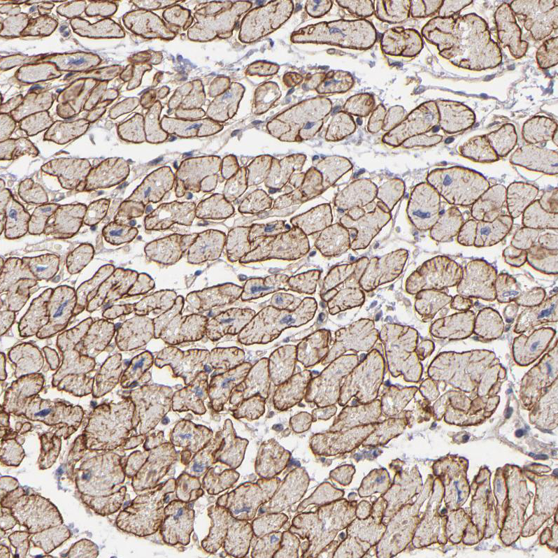 Immunohistochemistry (Formalin/PFA-fixed paraffin-embedded sections) - Anti-Dystrophin antibody (AB251665), expandable thumbnail