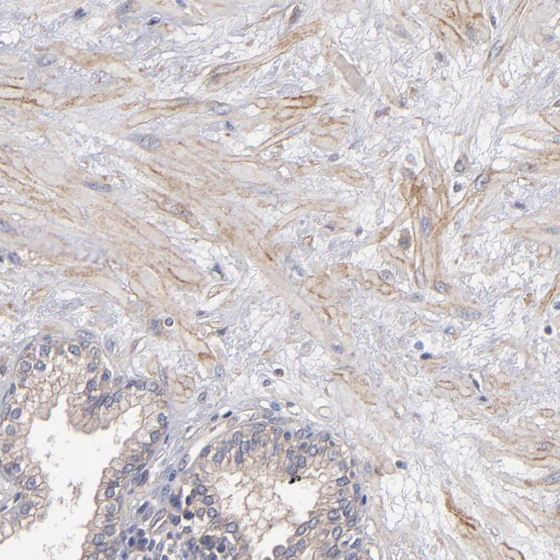 Immunohistochemistry (Formalin/PFA-fixed paraffin-embedded sections) - Anti-Dystrophin antibody (AB251665), expandable thumbnail